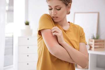 Can I Break Out In A Rash By Taking CBD Gummies?